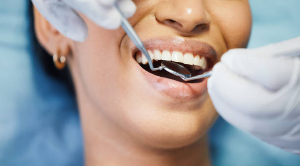 Best Emergency Cosmetic Dentistry (e.g., broken veneers) in Bangor Base, WA