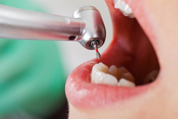 Best 24-Hour Emergency Dental Care in Bangor Base, WA